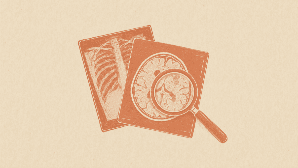 A BI-RADS Score Is a Plan, Not a Verdict: How to Read a Mammogram Report