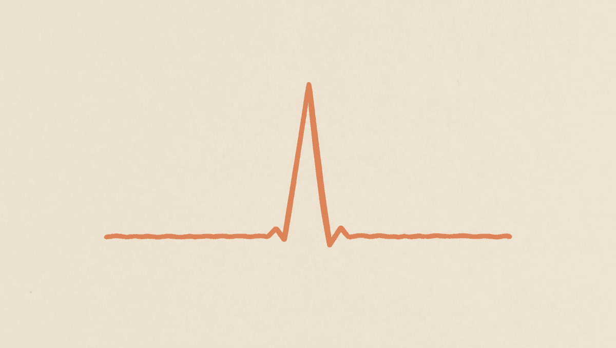 Pounding Headaches and Spells of High Blood Pressure: Pheochromocytoma