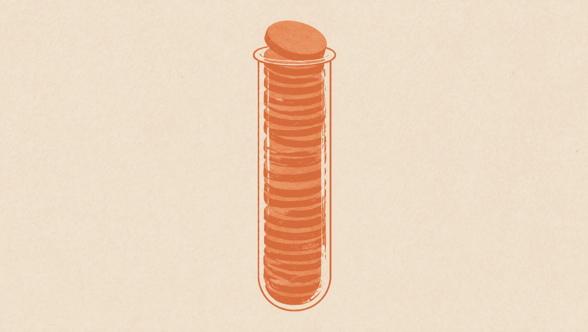 A High Hemoglobin Is Not Always Dehydration: Reading Polycythemia Vera