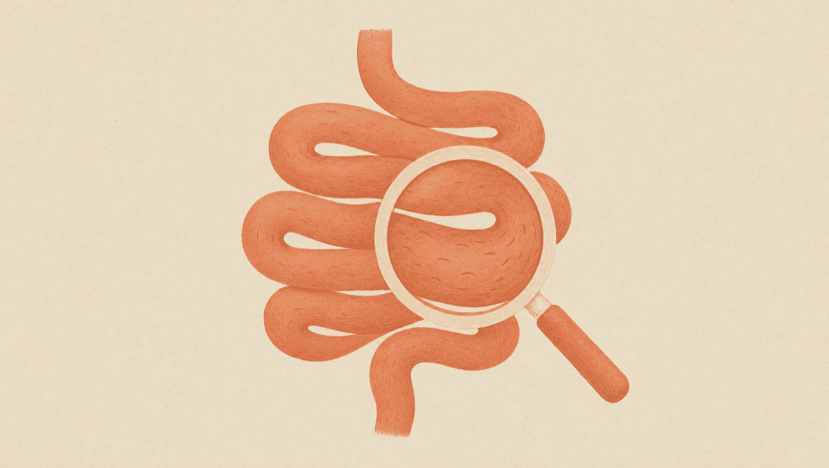 It's Just IBS Is a Label, Not a Cause: The Root-Cause Workup Behind Irritable Bowel Syndrome