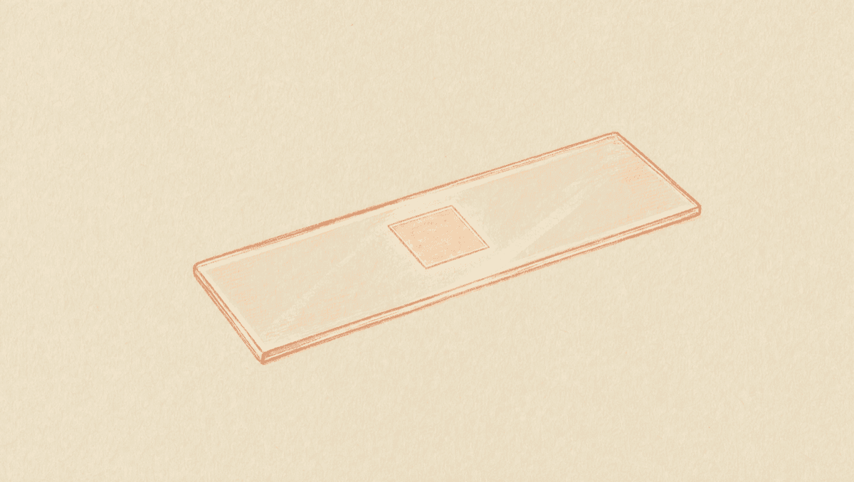 A Biopsy Result Is One Reading, Not the Last Word: How to Read a Tissue Report