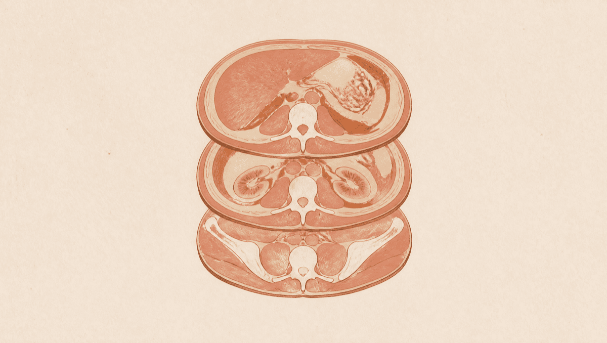 The Impression Is Not the Whole Scan: How to Read a CT Report and Catch What It Downplays