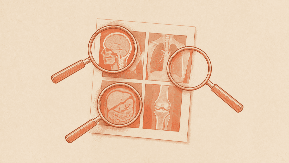 Even Good Oncologists Make Mistakes: How 12 Opinions Saved a Founder With Lymphoma