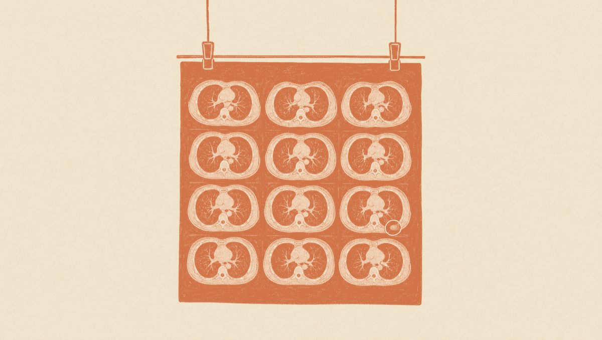 The Answer Is Not the Impression Line: How to Read an MRI Report and Catch What It Downplays